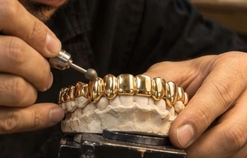 Gold Grillz - Image 2