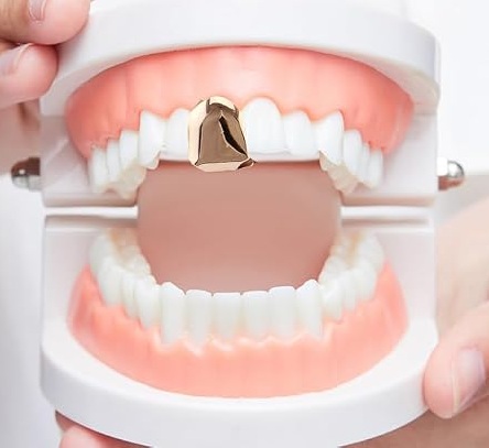 molding